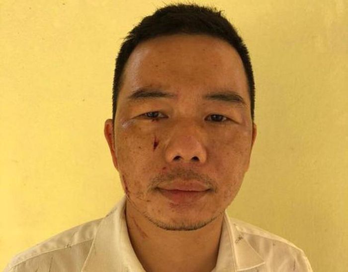  Mâu thuẫn trong chiếu bạc, hung thủ dùng dao đâm đối phương: Trong lúc đánh bạc đã xảy ra mâu thuẫn cự cãi lẫn nhau, Lê Văn Chung (SN 1986) đã dùng dao đâm anh V. L (SN 1986, cùng trú huyện Mê Linh, Hà Nội). Hậu quả là anh L. bị tổn hại sức khỏe với tỉ lệ là 19%. Ngày 28/6, Công an huyện Mê Linh cho biết, đang tạm giữ Chung để điều tra hành vi cố ý gây thương tích. 