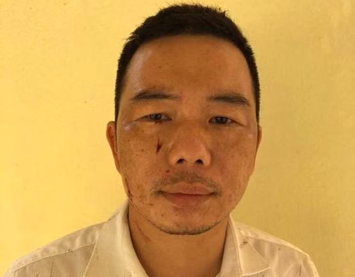  Mâu thuẫn trong chiếu bạc, hung thủ dùng dao đâm đối phương: Trong lúc đánh bạc đã xảy ra mâu thuẫn cự cãi lẫn nhau, Lê Văn Chung (SN 1986) đã dùng dao đâm anh V. L (SN 1986, cùng trú huyện Mê Linh, Hà Nội). Hậu quả là anh L. bị tổn hại sức khỏe với tỉ lệ là 19%. Ngày 28/6, Công an huyện Mê Linh cho biết, đang tạm giữ Chung để điều tra hành vi cố ý gây thương tích. 