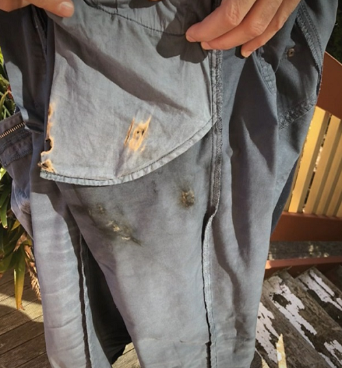 Chiếc iPhone X phát nổ khiên De Rose bị "bỏng độ hai" ở đùi. Ông đã liên hệ với Apple nhiều lần về vấn đề này, nhưng không nhận được phản hồi.