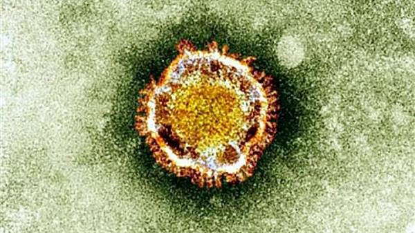 Chủng mới này là betacoronavirus, có liên quan mật thiết đến SARS- CoV và việc lây truyền từ người sang người có xảy ra. Nó có 70% đặc tính di truyền của SARS- CoV, nhưng 30% sự khác biệt có thể tạo ra những thay đổi sinh học lớn.