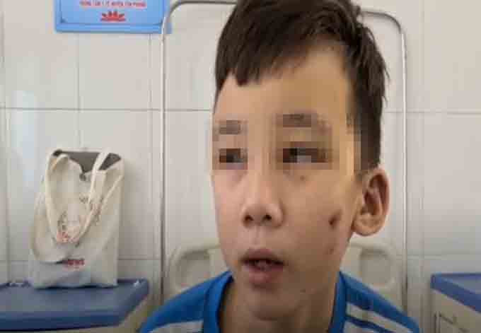 Chu quan banh xeo tra tan nhan vien: Toan phai an do thua cua khach