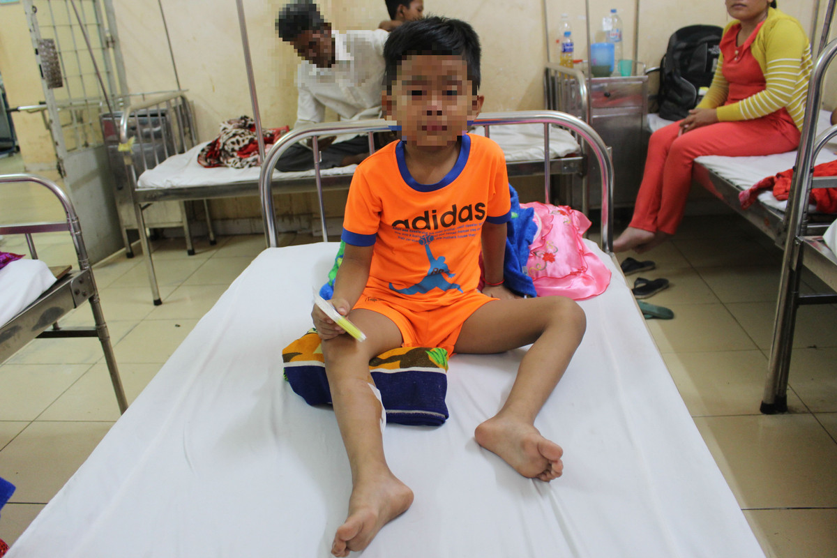 Ban ha con khi duc hoang can chau be o Soc Trang