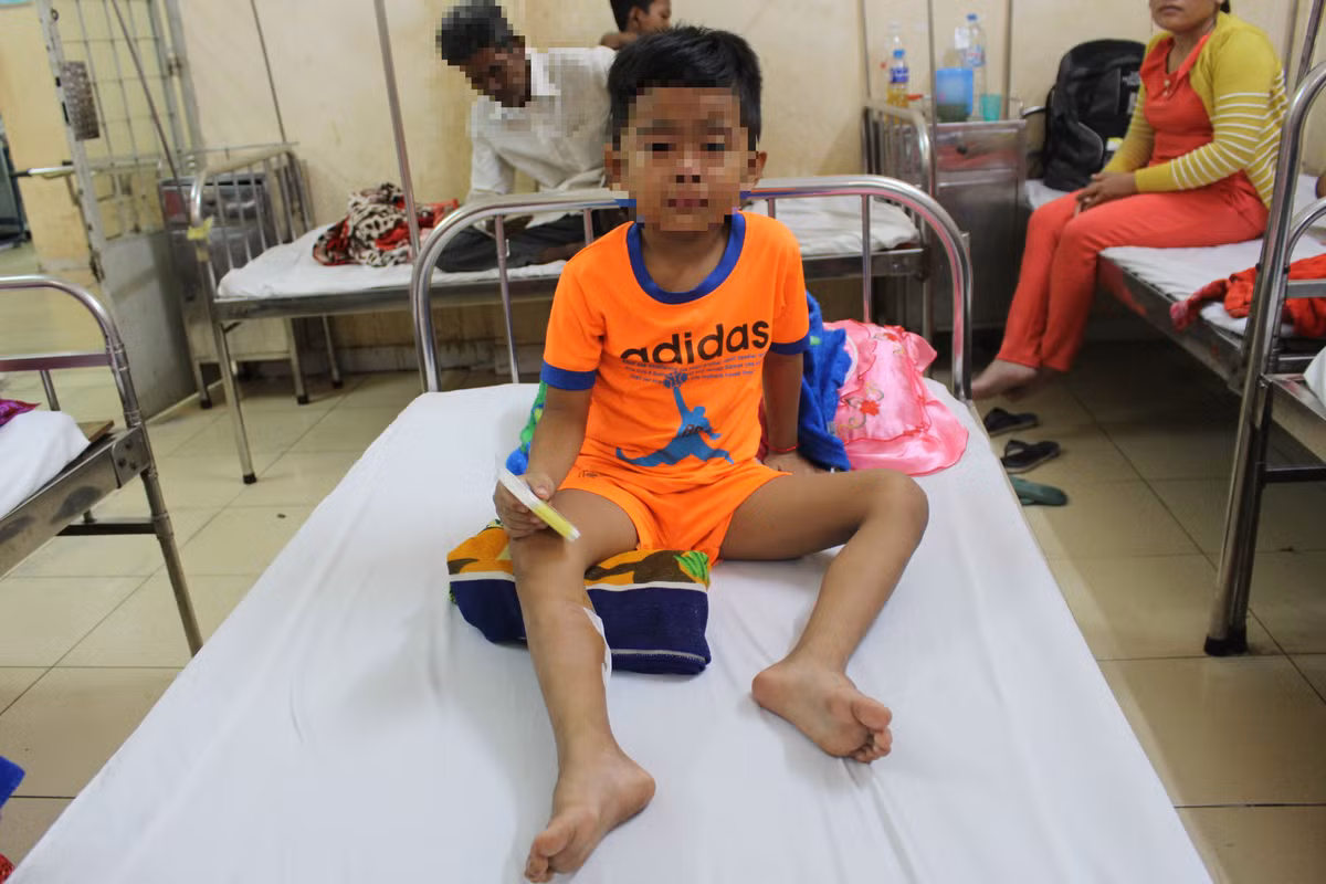 Ban ha con khi duc hoang can chau be o Soc Trang