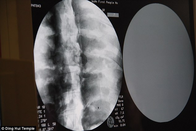 Sau khi thiền sư Ci Xian viên tịch, các đệ tử tiến hành bảo quản. Thế nhưng, xác ướp của nhà sư danh tiếng này biến mất trong nhiều năm.