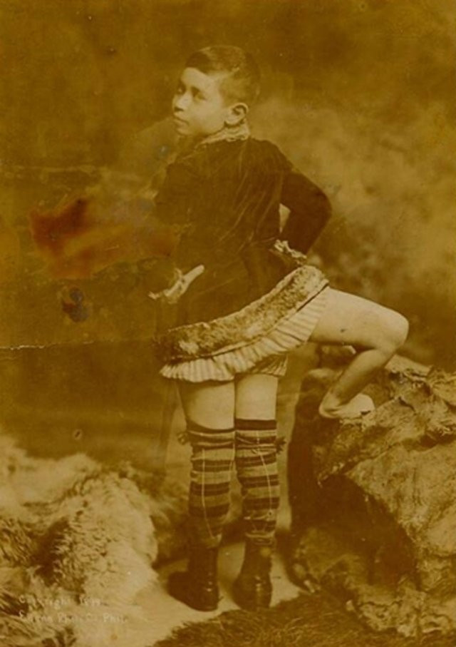 Theo một số nhà nghiên cứu, người đàn ông 3 chân Francesco "Frank" Lentini chào đời trong khoảng thời gian từ tháng 7/1884 - 5/1889 ở Rosolino, Italy. Ông lớn lên trong gia đình có 12 người con. Ông chuyển đến Mỹ sinh sống từ năm 8 tuổi.