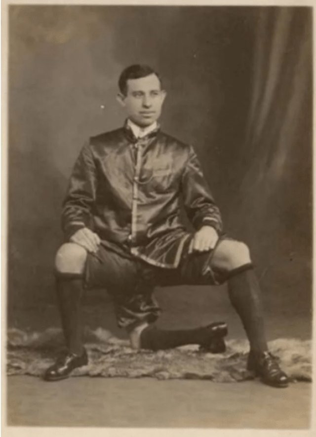 Lentini thực chất là một cặp song sinh dính liền. Trong thời gian ở trong bụng mẹ, cơ thể của hai anh em có cột sống dính liền nhưng có xương chậu và bộ phận riêng.