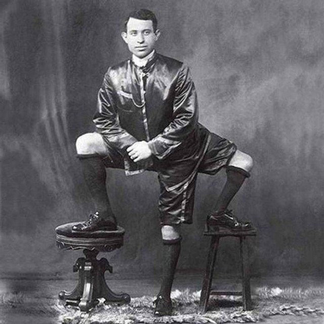 Ngay từ khi sinh ra, Lentini có ngoại hình khác biệt với mọi người. Thay vì có 2 chân, ông có 3 chân. Trong đó, ông có 2 chân giống người thường và thêm 1 chân ở hông bên phải.