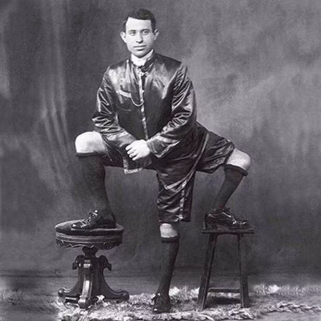 Ngay từ khi sinh ra, Lentini có ngoại hình khác biệt với mọi người. Thay vì có 2 chân, ông có 3 chân. Trong đó, ông có 2 chân giống người thường và thêm 1 chân ở hông bên phải.