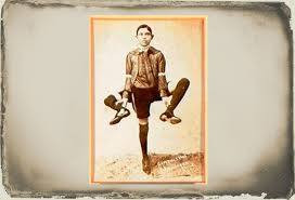 Điều khó tin là Lentini hấp thụ một phần cơ thể của người anh em song sinh. Do đó, khi chào đời, ông trở thành người có 3 chân và 2 bộ phận sinh dục.