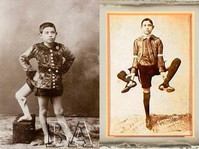 Ba chiếc chân của Lentini lần lượt có kích thước: 99 cm, 96 cm và 91 cm. Ông có tất cả 16 ngón chân.