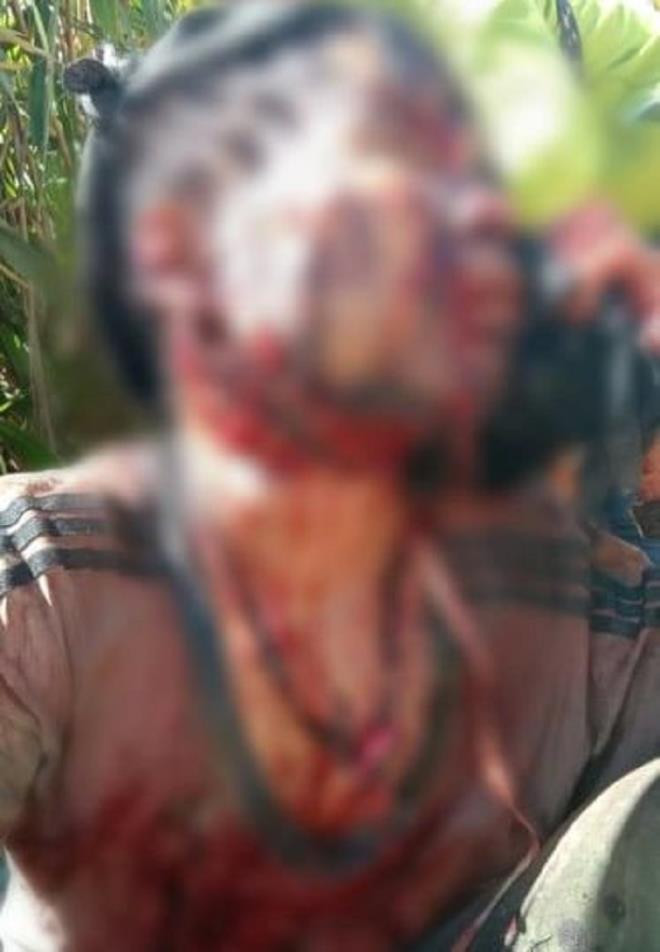 Bi gau rung tan cong, nguoi dan ong o Quang Nam nguy kich