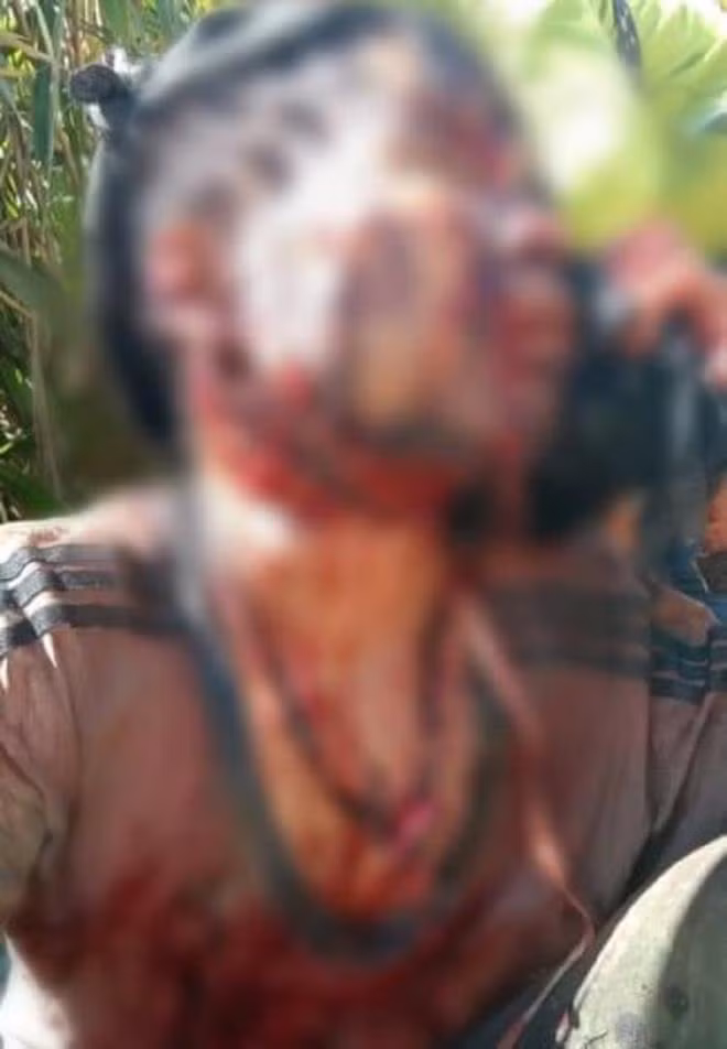 Bi gau rung tan cong, nguoi dan ong o Quang Nam nguy kich