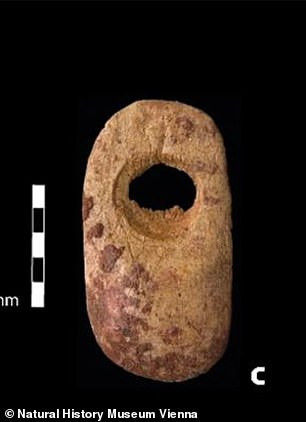 Tuy nhiên, một trong 2 đứa trẻ sống từ 6 - 7 tháng rồi qua đời. Trong khi ấy, đứa trẻ còn lại chết sau sinh khoảng 13 - 14 tuần.