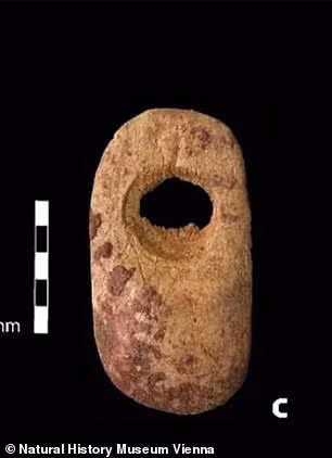 Tuy nhiên, một trong 2 đứa trẻ sống từ 6 - 7 tháng rồi qua đời. Trong khi ấy, đứa trẻ còn lại chết sau sinh khoảng 13 - 14 tuần.