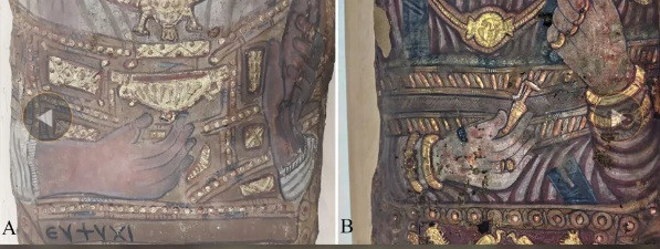 Tuy nhiên, hiện các chuyên gia chưa thể tìm ra nguyên nhân tử vong của họ. Các chuyên gia mới phát hiện người phụ nữ gặp một số vấn đế về sức khỏe, trong đó có bệnh viêm khớp.