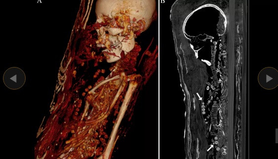 Chính vì vậy, các chuyên gia xem đây là những tấm vải liệm xác ướp đẹp nhất thế giới từng được phát hiện.