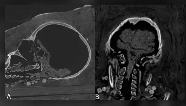 Kết quả kiểm tra cho thấy 2 xác ướp này qua đời vào khoảng năm 30 trước Công nguyên đến năm 395 sau Công nguyên.