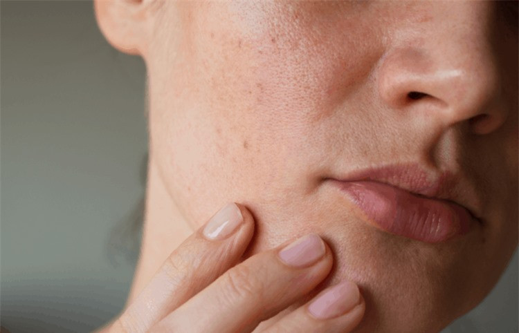 Thay 4 dau hieu tren mat nay co the ban mac benh phu khoa