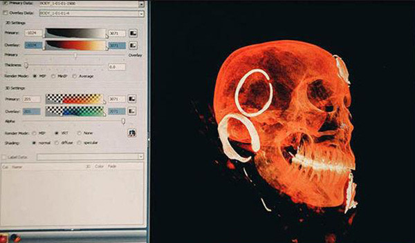 Bên trong quan tài chứa xác ướp của một phụ nữ. Tình trạng xác ướp còn nguyên vẹn đến mức khó tin khi lông mi và mái tóc không bị phân hủy.