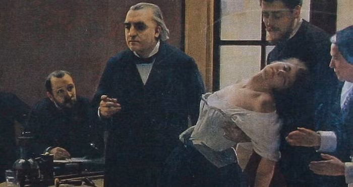 Ông Cotard có ghi lại trường hợp một bệnh nhân giấu tên được gọi là "quý bà X". Người này có một số biểu hiện bất thường như nghĩ rằng bản thân không có não, dây thần kinh, ngực hay dạ dày.