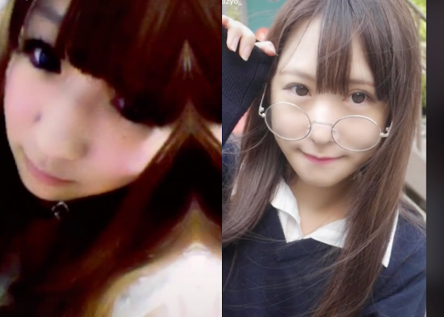 Được biết, cô đã bắt đầu phẫu thuật thẩm mỹ thay đổi ngoại hình của mình từ năm lớp 3. Hiện tại cô đã chi hơn 10 triệu yên (72.000 USD, tức gần 1,8 tỉ đồng) thực hiện nhiều cuộc phẫu thuật, để có được ngoại hình xinh đẹp, đáng yêu và tự nhiên như mong ước.