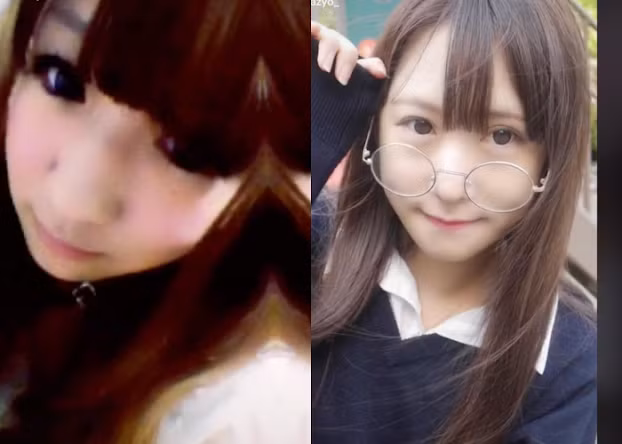 Được biết, cô đã bắt đầu phẫu thuật thẩm mỹ thay đổi ngoại hình của mình từ năm lớp 3. Hiện tại cô đã chi hơn 10 triệu yên (72.000 USD, tức gần 1,8 tỉ đồng) thực hiện nhiều cuộc phẫu thuật, để có được ngoại hình xinh đẹp, đáng yêu và tự nhiên như mong ước.