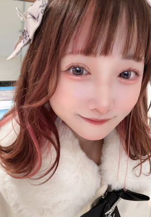 Nhờ phẫu thuật thẩm mỹ mà Zirazyo lại luôn được các bạn học cấp 3 ca ngợi về vẻ ngoài xinh xắn.