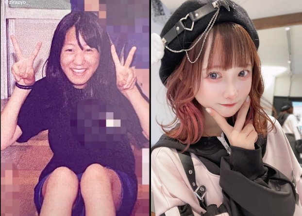Một gái xinh người Nhật tên Zirazyo thời gian qua gây chú ý khi công khai thực hiện "dao kéo" thay đổi nhan sắc từ năm lớp 3. Màn "vịt hóa thiên nga" của cô gái này khiến nhiều người bất ngờ.