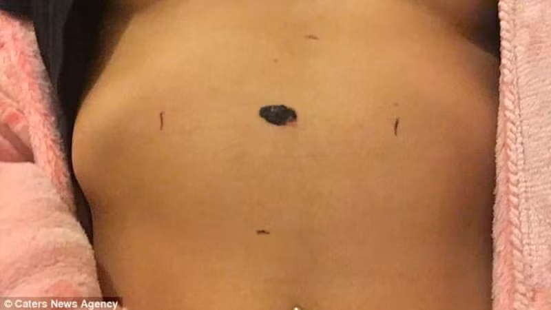 Cham chi chup anh tu suong mac bikini, co gai thoat chet ngoan muc-Hinh-2