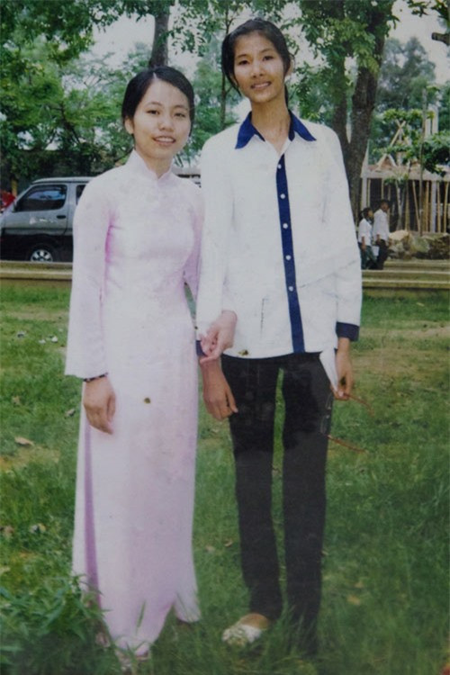 Cô gái gốc Thanh Hóa từng bị giang hồ làm luật, đe dọa, đánh tới mức để lại vết sẹo dài trên mặt.