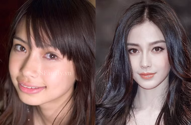  Angelababy bị nghi ngờ đã trải qua nhiều cuộc phẫu thuật thẩm mỹ để biến “vịt” thành “thiên nga”.