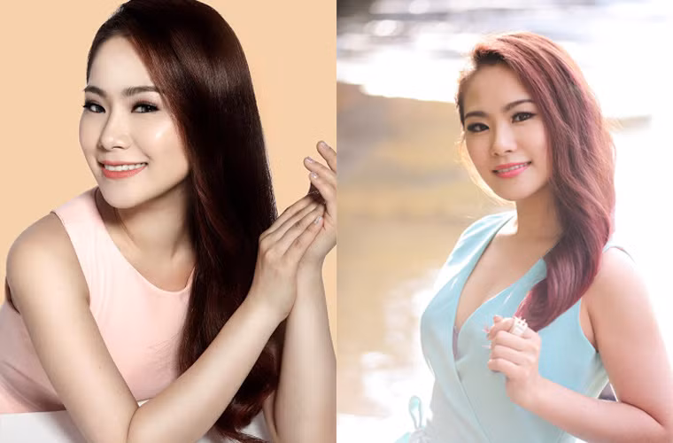 Tai nạn bỏng khiến Bích Hữu mất một năm trời điều trị gương mặt mới trở lại bình thường như xưa.