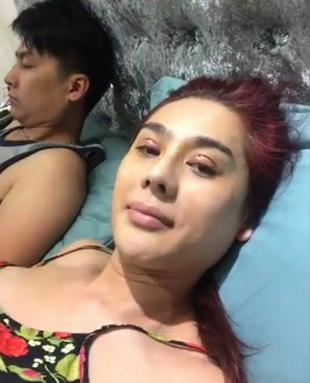 Sau khi thừa nhận cắt mí mắt, “công chúa” tự tin livestream để lộ cả đường chỉ cắt mí và hai mí vẫn còn sưng vì chưa lành.