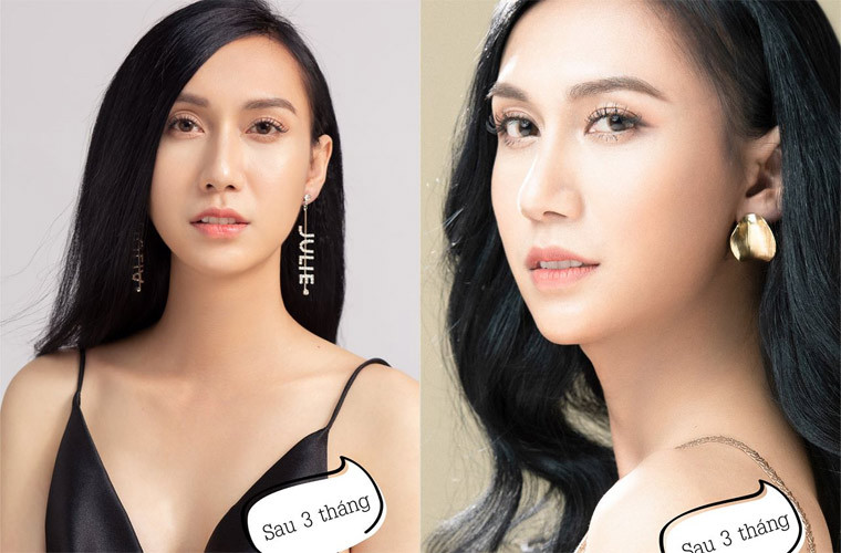 Sau ba tháng dao kéo, hình ảnh của Lynk Lee giờ thực sự là một cô gái xinh đẹp, quyến rũ.