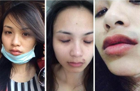 Nàng hậu tung bằng chứng cho thấy cô thường xuyên bị chồng đại gia đánh đập, chửi bới, đe dọa. Cô ngậm ngùi ra đi tay trắng sau ly hôn.