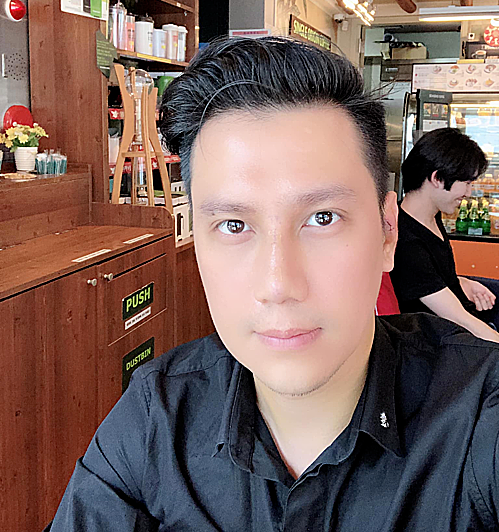 Soi ngoai hinh thay doi that thuong cua Viet Anh hau “dao keo“-Hinh-2