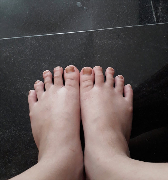 Bản thân Đỗ Thị Hà từng khoe đôi bàn chân xấu xí của mình lên trang cá nhân.