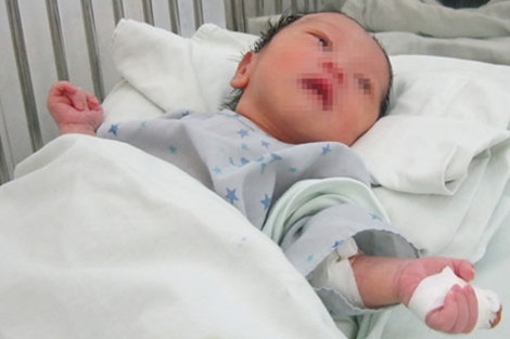 Can dut ngon tay tre so sinh... tru ta chan dong Dong Nai-Hinh-3