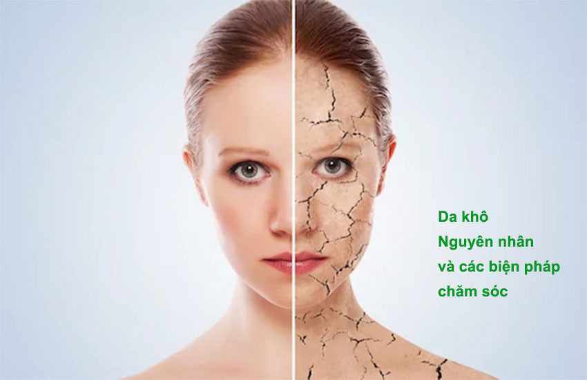 Bat mi 2 cach dap mat na giup da het kho, trang hong min mang