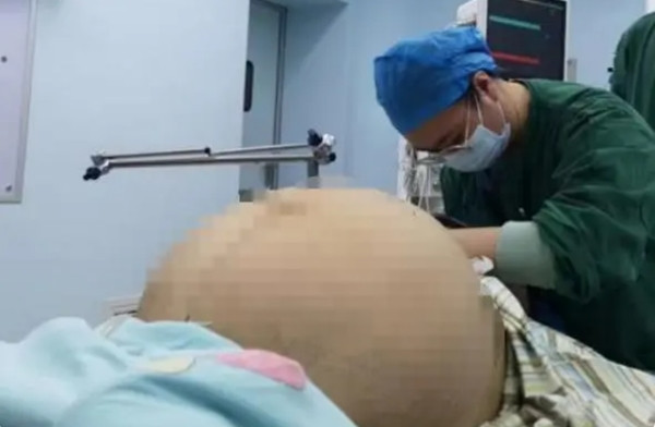 Tuong mang thai doi, nao ngo co gai co khoi u nang 21 kg