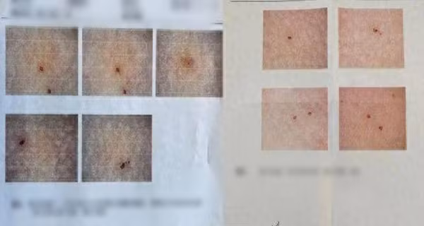 Phat hien 12 lo kim tren nguoi con trai, me kien co giao