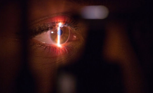 Con nho keo 502 vao mat, cach bo xu ly duoc bac si khen