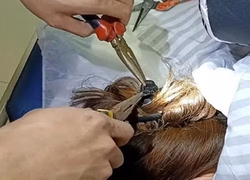 Kẹp tóc kiểu này, người phụ nữ suýt mất mạng Kep toc kieu nay, nguoi phu nu suyt mat mang