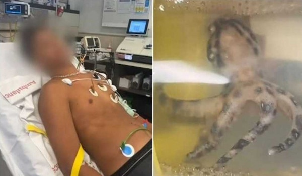 Nhat vo so, chang trai dung do “thuy quai” doc hon ran ho mang