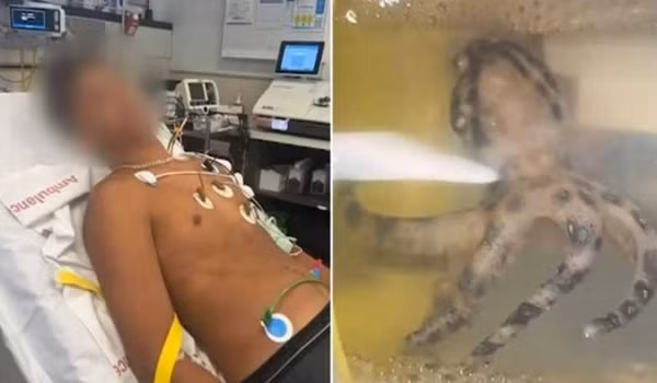 Nhat vo so, chang trai dung do “thuy quai” doc hon ran ho mang