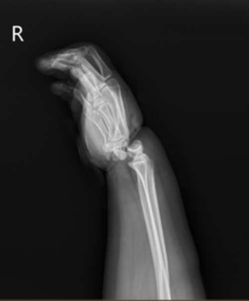 Choi keo co voi con, me suyt dut lia tay vi dieu nay