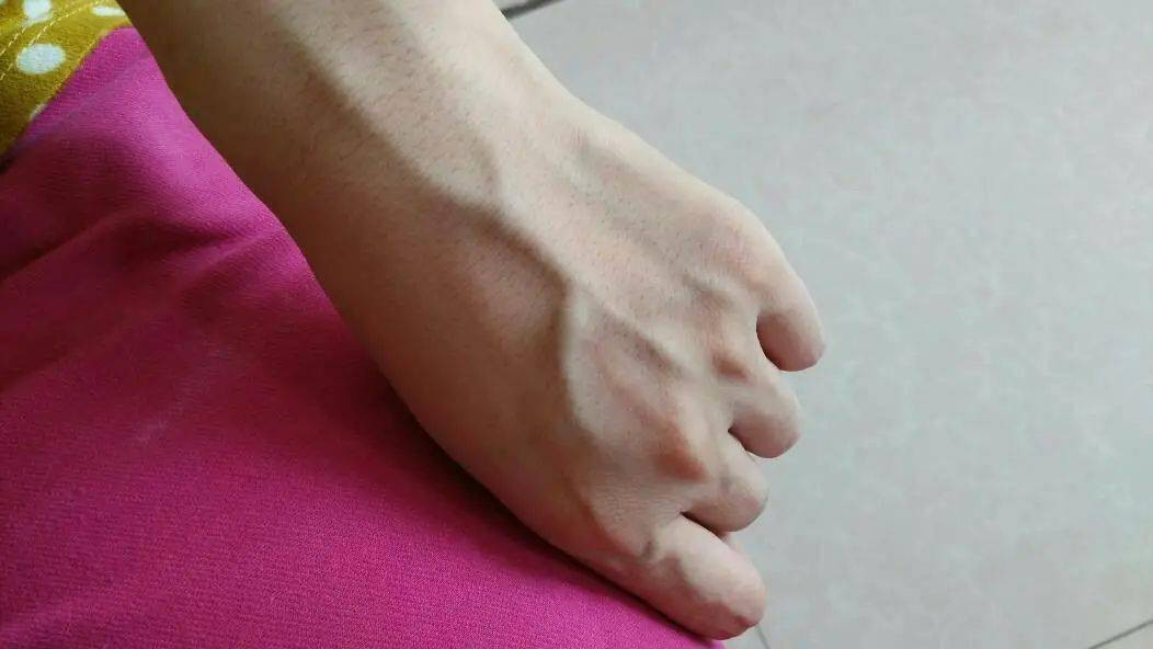 Nhin gan xanh noi cho nao doan ngay ra benh cho do