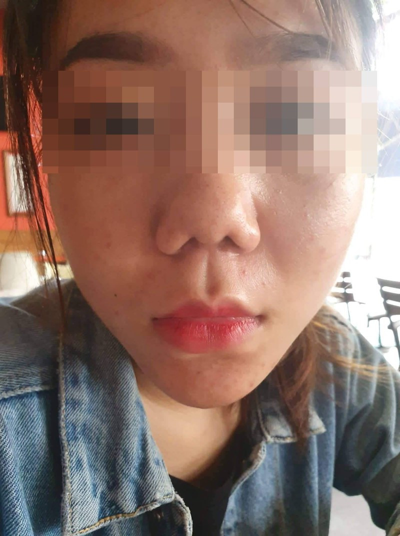 Vụ khách hàng tố Klain Beauty làm hỏng mũi: Công ty Klain dính phạt nhiều vi phạm - Hình 2 Vu khach hang to Klain Beauty lam hong mui: Cong ty Klain dinh phat nhieu vi pham-Hinh-2