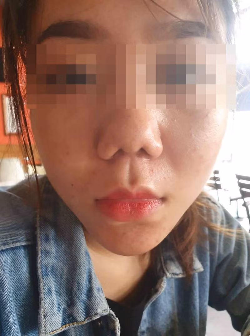 Vu khach hang to Klain Beauty lam hong mui: Cong ty Klain dinh phat nhieu vi pham-Hinh-2