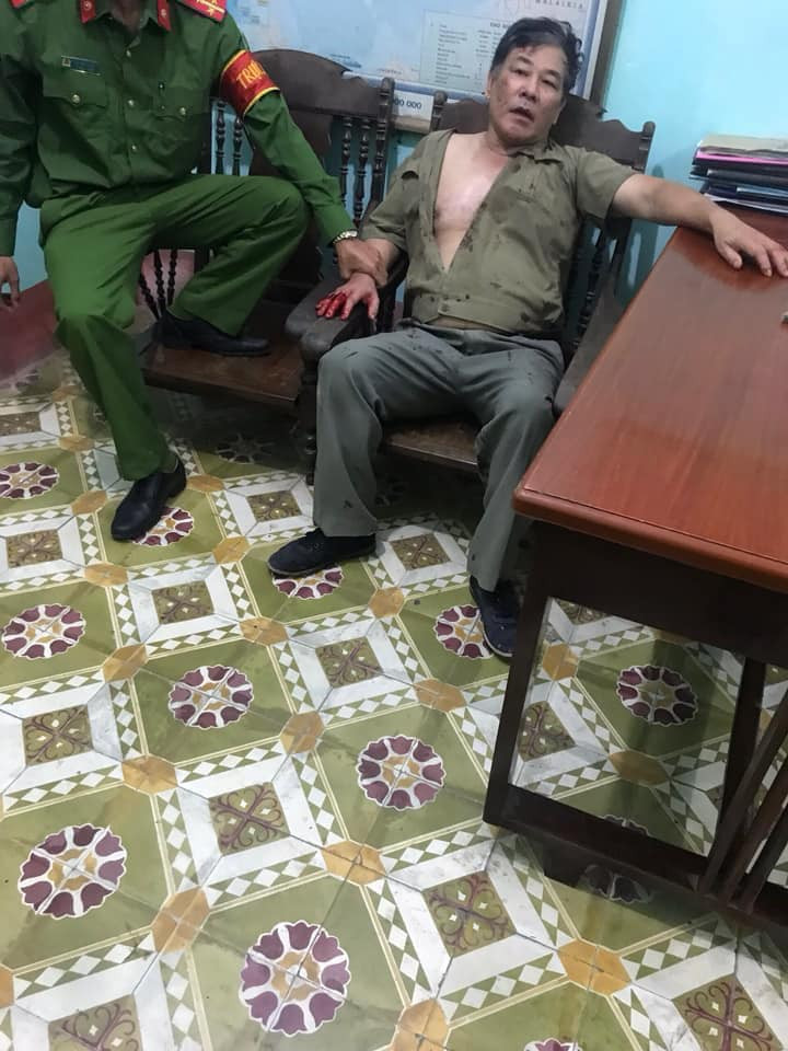 Mục đích của ông Hồng là tìm gặp anh Nguyễn Thành Vương (38 tuổi, con rể bà Hà) để đòi nợ số tiền là 3 tỷ đồng. Nạn nhân hiện đang được điều trị tại bệnh viện.